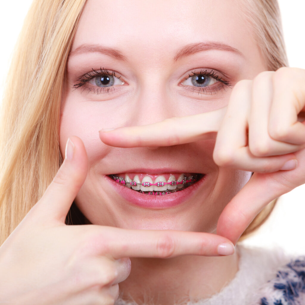 What Age Are Braces Necessary Valderrama Orthodontics what-age-are-braces-necessary-valderrama-orthodontics
